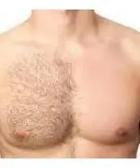 DEPILAZIONE UOMO/DONNA A BRESCIA