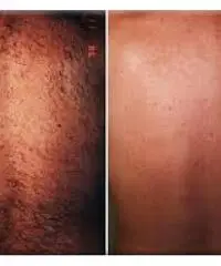 DEPILAZIONE UOMO/DONNA A BRESCIA